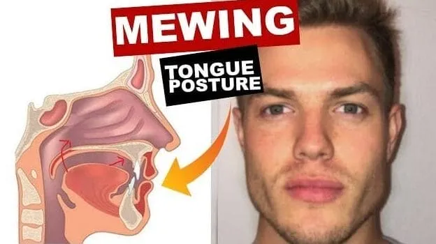 Mewing
